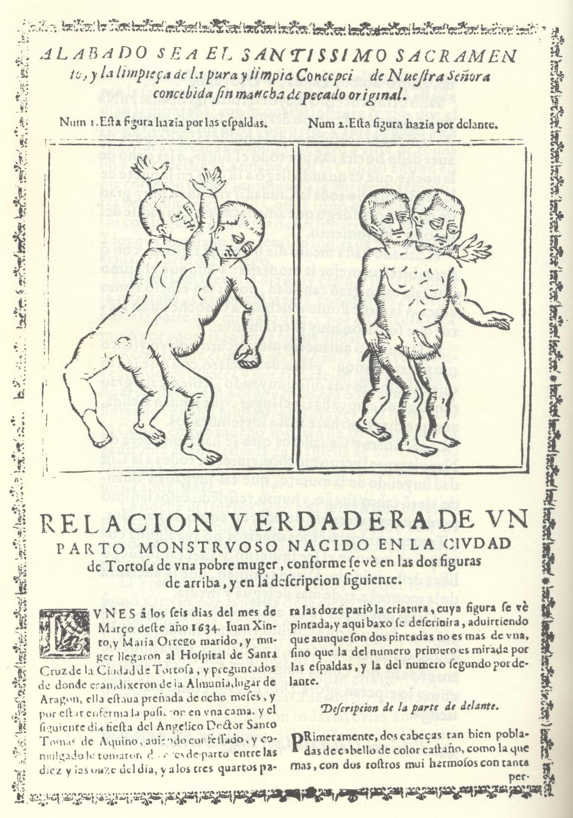 17th-century tabloid about a “monstrous birth” of conjoined twins. This is an example of tabloids that were written about inexplicable moments in life. Photo provided by Hilaire Kallendorf.