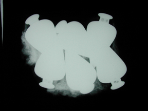 an X-ray of a small, paper-wrapped package containing six brass plumb bobs