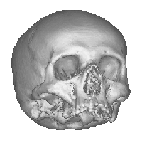scanned image of the upper skull