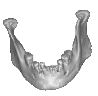 mandible or jawbone 3-D scan