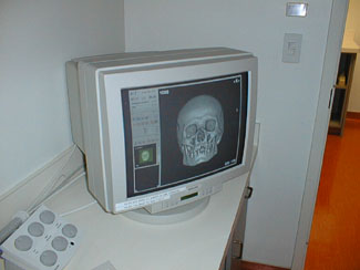 image of the scanned skull on a computer screen