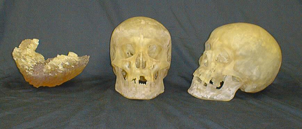 cast resin replicas of the brain in the cranium, and two exact replicas of the full skull
